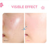 BKKFinds Cherry Blossom Cream BKKFinds Health, Beauty & Hair / Beauty Tools / F Cherry Blossom Moisturizing Face Cream 25 g