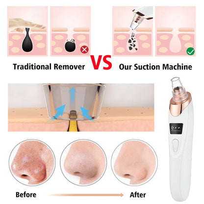 Rechargeable Portable Blackhead Remover Face Vacuum Nose Pore Cleaner Extractor Skin Care Tool