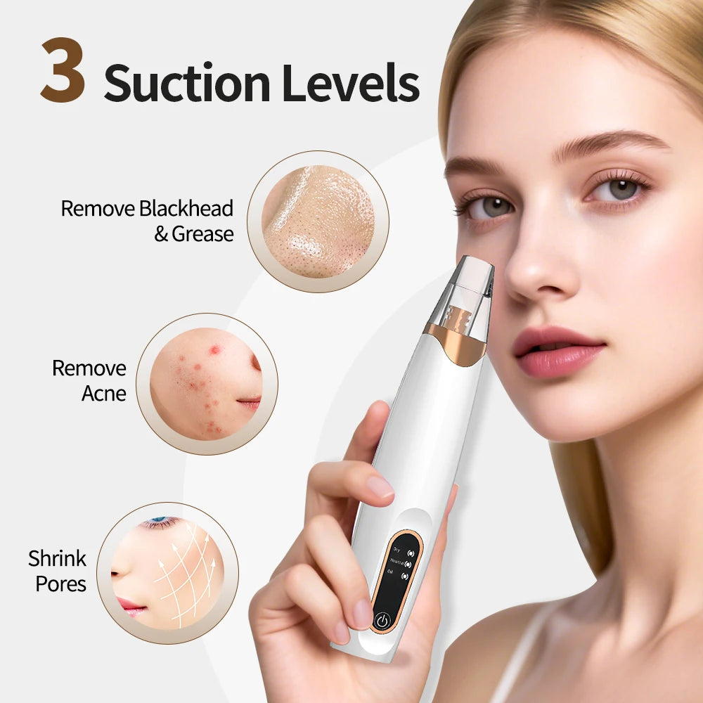 Rechargeable Portable Blackhead Remover Face Vacuum Nose Pore Cleaner Extractor Skin Care Tool