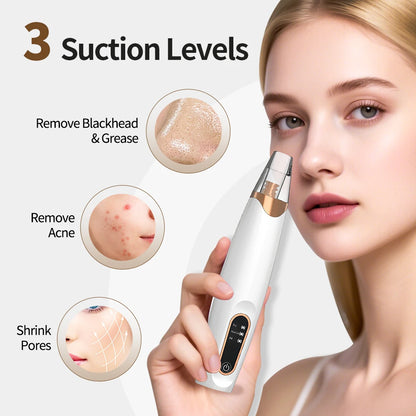 Rechargeable Portable Blackhead Remover Face Vacuum Nose Pore Cleaner Extractor Skin Care Tool