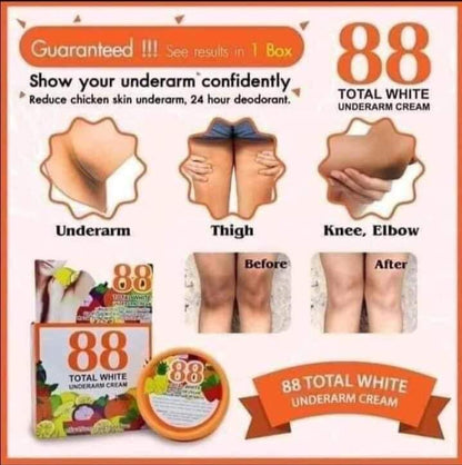 S88 Total White Underarm Cream (35g) - BKKFinds